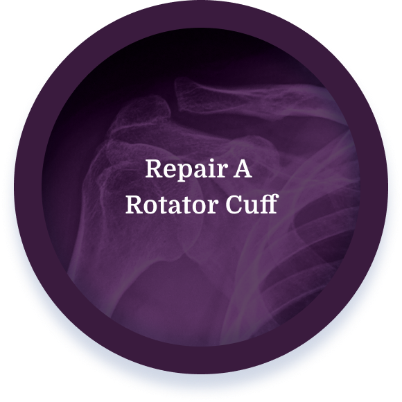 Repair A Rotator Cuff